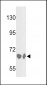 BF Antibody (Center)